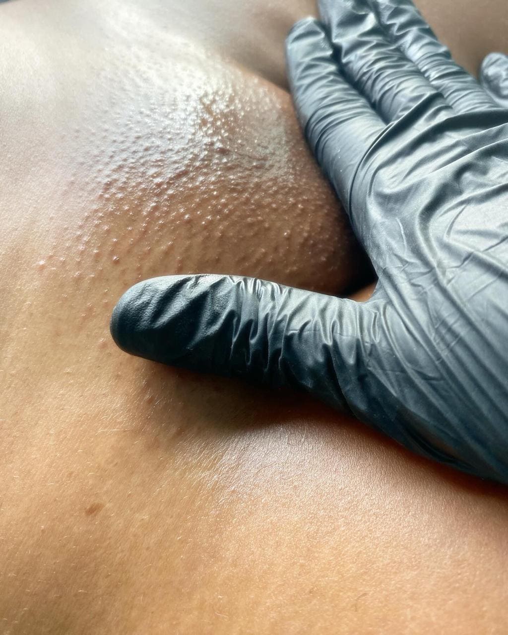 intimo1